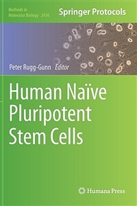 Human naïve pluripotent stem cells